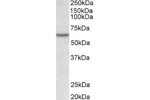 Western Blotting (WB) image for anti-Lymphocyte-Specific Protein tyrosine Kinase (LCK) (AA 39-52) antibody (ABIN1102819) (LCK 抗体  (AA 39-52))