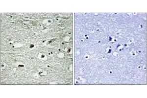 Immunohistochemistry analysis of paraffin-embedded human brain, using hnRNP C1/2 (Phospho-Ser260) Antibody. (HNRNPC 抗体  (pSer260))