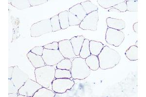 Immunohistochemistry of paraffin-embedded rat skeletal muscle using Dystrophin Rabbit mAb (ABIN7266871) at dilution of 1:100 (40x lens). (Dystrophin 抗体)