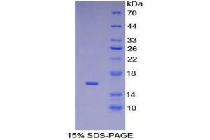 SDS-PAGE analysis of Human Keratin 15 Protein.