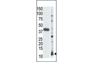 Image no. 1 for anti-Small Ubiquitin Related Modifier Protein 1 (SUMO1) antibody (ABIN356806) (SUMO1 抗体)