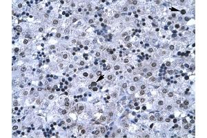 FOXG1A antibody was used for immunohistochemistry at a concentration of 4-8 ug/ml to stain Hepatocyte (arrows) in Human Liver. (FOXG1 抗体  (N-Term))