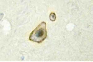 Immunohistochemistry analysis of CYP19A1 Antibody in Paraffin-Embedded Human brain tissue. (Aromatase 抗体)