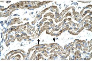 Human Muscle; HumanMuscle; C13ORF8 antibody - middle region in Human Muscle cells using Immunohistochemistry (ZNF828 抗体  (Middle Region))