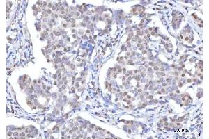 IHC analysis of RANBP2 using anti-RANBP2 antibody (ABIN7602650). (RANBP2 抗体  (AA 906-2744))