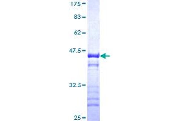 TRIM37 Protein (AA 865-964) (GST tag)