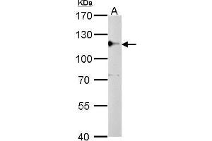 WB Image CYLD antibody detects CYLD protein by Western blot analysis. (CYLD 抗体  (C-Term))