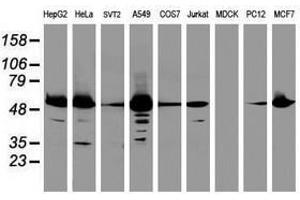 Image no. 1 for anti-Epoxide Hydrolase 1, Microsomal (Xenobiotic) (EPHX1) (AA 21-230) antibody (ABIN1491197) (EPHX1 抗体  (AA 21-230))