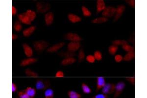 Immunofluorescence analysis of HeLa cells using CYP1B1 Polyclonal Antibody at dilution of 1:100 (40x lens). (CYP1B1 抗体)