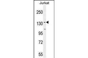 Western blot analysis in Jurkat cell line lysates (35ug/lane). (PPP1R3A 抗体  (AA 754-782))