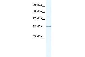 Western Blotting (WB) image for anti-Nudix (Nucleoside Diphosphate Linked Moiety X)-Type Motif 9 (NUDT9) (C-Term) antibody (ABIN2776344)