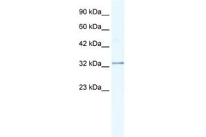 WB Suggested Anti-NUDT9 Antibody Titration:  0. (NUDT9 抗体  (C-Term))