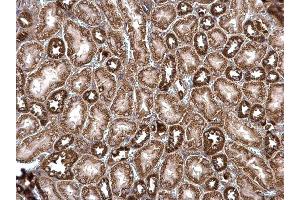 IHC-P Image ROCK2 antibody detects ROCK2 protein at cytosol on mouse kidney by immunohistochemical analysis. (ROCK2 抗体)