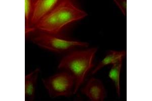 Immunofluorescence of human HeLa cells stained with Phalloidin-TRITC (Red) for Actin staining and monoclonal anti-human UBE2S antibody (1:500) with Alexa 488 (Green). (UBE2S 抗体  (AA 1-222))
