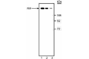 Western blot analysis of Abl. (ABL1 抗体)