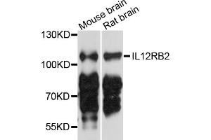 Western blot analysis of extracts of various cell lines, using IL12RB2 antibody (ABIN4904030) at 1:1000 dilution. (IL12RB2 抗体)