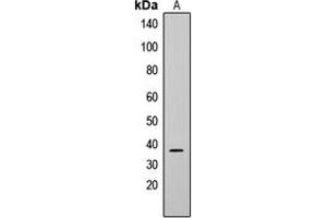 Western blot analysis of CD79b expression in Raji (A), K562 (B) whole cell lysates. (CD79b 抗体  (Center))