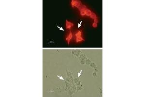 Immunocytochemistry (ICC) image for anti-Potassium Voltage-Gated Channel, Subfamily H (Eag-Related), Member 2 (KCNH2) (AA 1106-1159), (Intracellular) antibody (ABIN7043544)