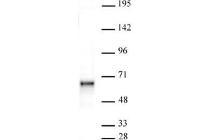 Sox11 antibody (pAb) tested by Western blot. (SOX11 抗体  (N-Term))