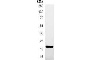 Immunoprecipitation of HA-tagged protein from HEK293T cells transfected with vector overexpressing HA tag, using Anti-HA-tag Antibody. (HA-Tag 抗体)