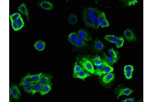 Immunofluorescent analysis of MCF-7 cells using ABIN7172914 at dilution of 1:100 and Alexa Fluor 488-congugated AffiniPure Goat Anti-Rabbit IgG(H+L) (TRAM2 抗体  (AA 316-370))