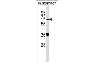 TDP1 Antibody (Center) (ABIN1538086 and ABIN2849232) western blot analysis in mouse stomach tissue lysates (35 μg/lane). (TDP1 抗体  (AA 212-239))