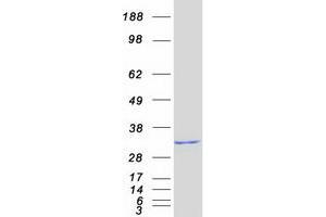 THAP Domain Containing, Apoptosis Associated Protein 1 (THAP1) (Transcript Variant 1) protein (Myc-DYKDDDDK Tag)