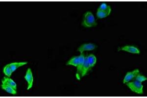 Immunofluorescent analysis of MCF-7 cells using ABIN7158547 at dilution of 1:100 and Alexa Fluor 488-congugated AffiniPure Goat Anti-Rabbit IgG(H+L) (FCGR3A 抗体  (AA 49-184))
