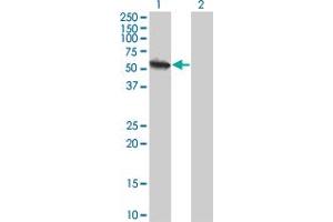 Western Blot analysis of USP3 expression in transfected 293T cell line by USP3 monoclonal antibody (M01), clone 1H2. (USP3 抗体  (AA 421-520))