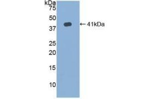 Detection of Recombinant HJV, Human using Polyclonal Antibody to Hemojuvelin (HJV)