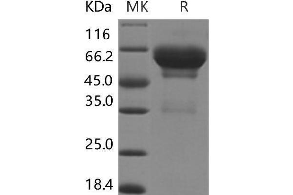 SCG3 Protein (His tag)