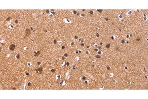 Immunohistochemistry of paraffin-embedded Human brain tissue using CSNK1D Polyclonal Antibody at dilution 1:50 (Casein Kinase 1 delta 抗体)