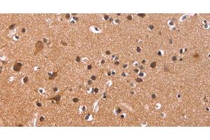 Immunohistochemistry of paraffin-embedded Human brain tissue using CSNK1D Polyclonal Antibody at dilution 1:50 (Casein Kinase 1 delta 抗体)