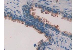 DAB staining on IHC-P; Samples: Human Prostate Tissue (PLAA 抗体  (AA 534-792))