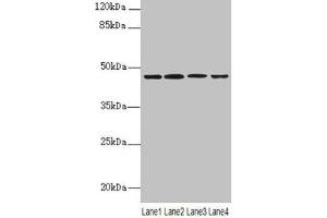 Western blot All lanes: NAPEPLD antibody at 6 μg/mL Lane 1: Mouse large intestine tissue Lane 2: Mouse kidney tissue Lane 3: Mouse stomach tissue Lane 4: MCF-7 whole cell lysate Secondary Goat polyclonal to rabbit IgG at 1/10000 dilution Predicted band size: 46 kDa Observed band size: 46 kDa (NAPEPLD 抗体  (AA 1-200))