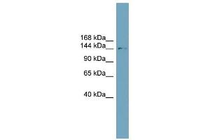 SLC4A2 antibody used at 1 ug/ml to detect target protein.