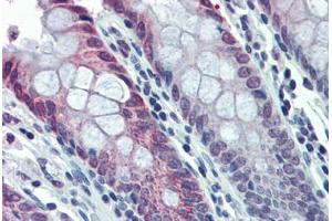 Human Colon: Formalin-Fixed, Paraffin-Embedded (FFPE) (HDAC2 抗体  (N-Term))