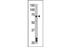 Image no. 2 for anti-TXK tyrosine Kinase (TXK) (N-Term) antibody (ABIN359999) (TXK 抗体  (N-Term))