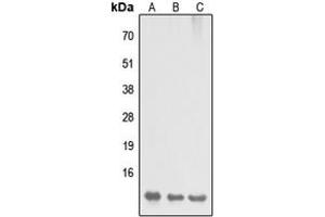 Western Blotting (WB) image for anti-Dynein, Light Chain, LC8-Type 2 (DYNLL2) (N-Term) antibody (ABIN7300624)