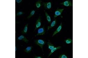 Immunofluorescence (IF) image for anti-B-Cell CLL/lymphoma 2 (BCL2) antibody (ABIN7305040)