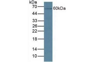 Detection of CYP27B1 in Mouse Kidney Tissue using Polyclonal Antibody to Cytochrome P450 27B1 (CYP27B1) (CYP27B1 抗体  (AA 251-500))