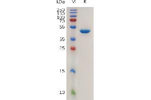 Human Protein, hFc Tag on SDS-PAGE under reducing condition.