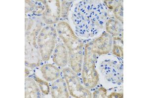 Immunohistochemistry of paraffin-embedded rat kidney using GFER antibody (ABIN5973176) at dilution of 1/100 (40x lens). (GFER 抗体)