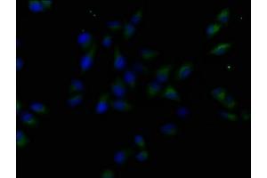Immunofluorescence staining of Hela cells with ABIN7158896 at 1:50, counter-stained with DAPI. (MST1R 抗体  (AA 1175-1400))