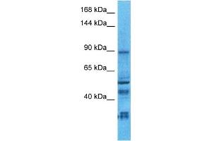 Host:  Rabbit  Target Name:  NLGN2  Sample Type:  Uterus Tumor lysates  Antibody Dilution:  1. (Neuroligin 2 抗体  (C-Term))