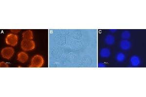 Expression of OX2R in human colon cancer cells - Immunocytochemical staining of paraformaldehyde-fixed and permeabilized human Colo-205 colon cancer cells using Anti-Orexin Receptor 2 Antibody (ABIN7043029, ABIN7044885 and ABIN7044886), (1:500), followed by goat-anti-rabbit-AlexaFluor-555 secondary antibody (red). (CD200R1 抗体  (C-Term, Intracellular))