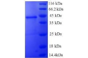 SDS-PAGE (SDS) image for Non-Metastatic Cells 1, Protein (NM23A) Expressed in (NME1) (AA 2-152), (full length) protein (GST tag) (ABIN7479605)