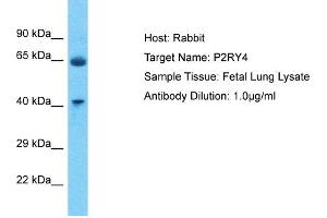 Host: Rabbit Target Name: P2RY4 Sample Type: Fetal Lung lysates Antibody Dilution: 1. (P2RY4 抗体  (C-Term))
