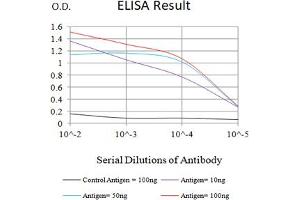 Black line: Control Antigen (100 ng),Purple line: Antigen (10 ng), Blue line: Antigen (50 ng), Red line:Antigen (100 ng) (SARS-CoV-2-NP3 (AA 240-419) 抗体)