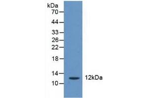 Western Blotting (WB) image for anti-CASP2 and RIPK1 Domain Containing Adaptor with Death Domain (CRADD) (AA 1-199) antibody (ABIN7436816)